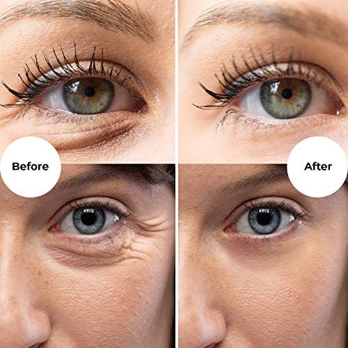 Gle Vitamin C Eye Serum for Dark Circles, Eye Wrinkles and Redness | Dark Circle Under Eye Puffy Eyes Treatment | Caffeine, Vitamin C Hyaluronic Acid | Hydrating & Brightening Scent-Free Travel Size