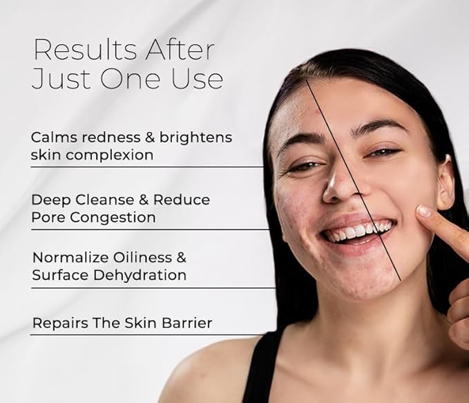 Bioactive Cleanser Oily Skin - Non-Foaming Facial Cleanser Provides a Gentle Deep Clean and Eliminates Excess Oil Face Wash (4.5 fl oz)