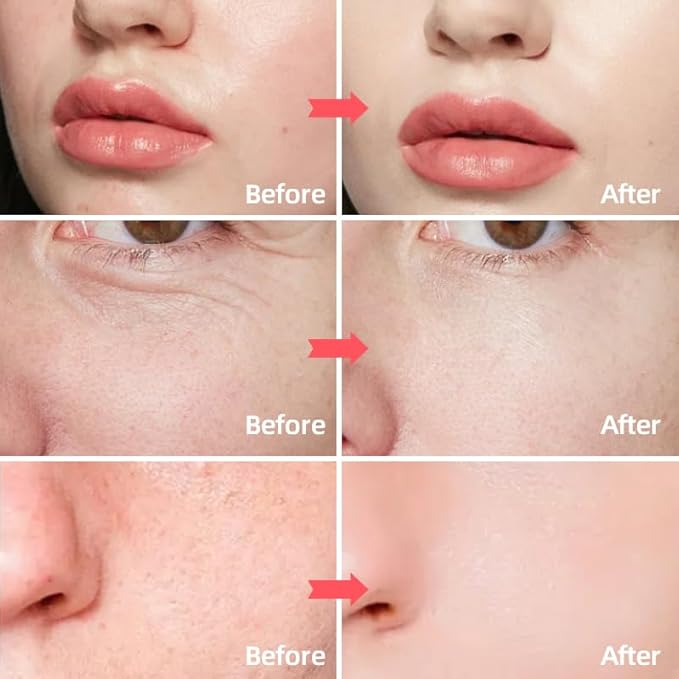 Retinol & Collagen Face Cream β Anti-Aging Moisturizer for Wrinkles & Fine Lines | Hyaluronic Acid & Peptides | Hydrates & Restores Skin Elasticity