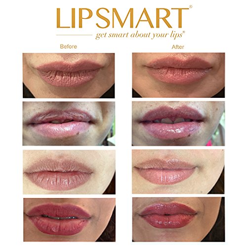 Lip Balm & Hydrating Lip Treatment (Medical Grade) - 0.33 Fl. Oz