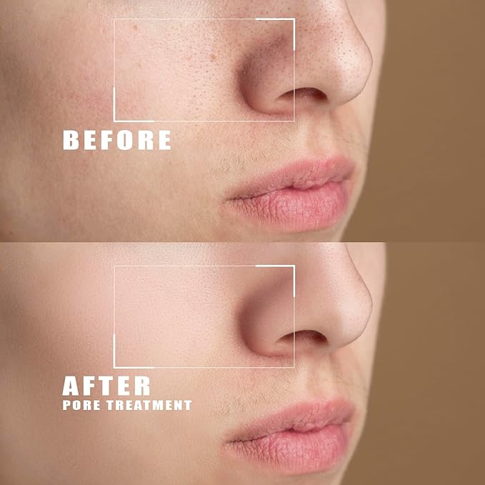 Body and Face Peeling Cream 200ml โ Facial Peeling Cream for Deep Cleansing, Exfoliation and Skin Moisturization โ for Face Dead Skin Removing, Pore-Unclogging & Skin-Smoothing