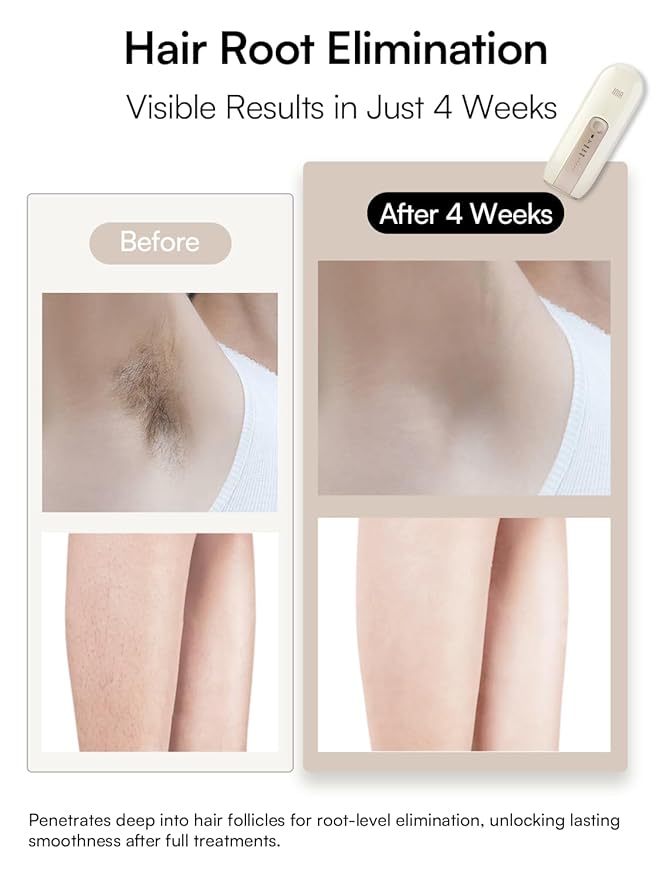 Laser Hair Removal Device for Women and Men, INIA Fond Hair Remover with Long-Lasting in Hair Reduction for Body&Face, Safe at-home Results for Armpits, Bikini and Legs
