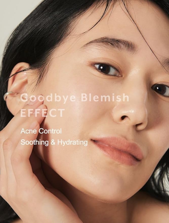 MIZON Goodbye Blemish Fresh Toner, BHA, Niacinamide for Excessive Sebum, Troubled Skin, Acne Treatment, Breakout Treatment, Korean Skincare, Acne Spot Treatment, Smooth Skin (120ml/4.05 fl. oz.)