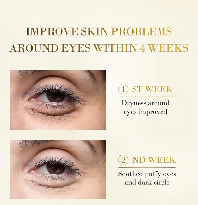 Senana MarinaUnder Eye Masks, Eye Lines And Moisturizing Eye Patches, Moisturizing, Nourishing, Improving Eye Bags, Dark Eye Circles, Under Eye Gel Pads with Collagen Hyaluronic Acid (60 Pieces) (24K Golden eye Collagen)