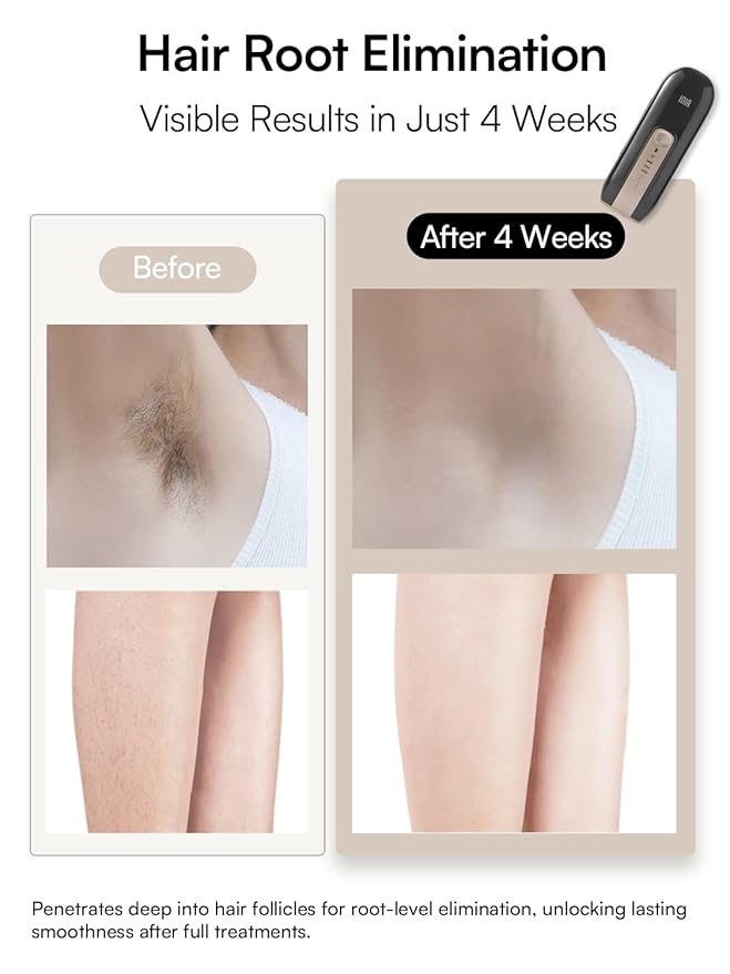 Laser Hair Removal Device for Women and Men, INIA Fond Hair Remover with Long-Lasting in Hair Reduction for Body&Face, Safe at-home Results for Armpits, Bikini and Legs