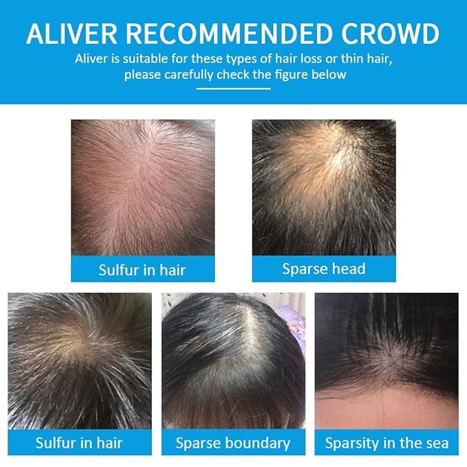 Aliver Hair Fibers for Thinning Hair with Spray Dark Brown - Undetectable Natural Formula - Thicker Fuller Hair in 15 Seconds - Conceals Hair Loss & Look Younger - Designed for Men & Women,0.97Oz