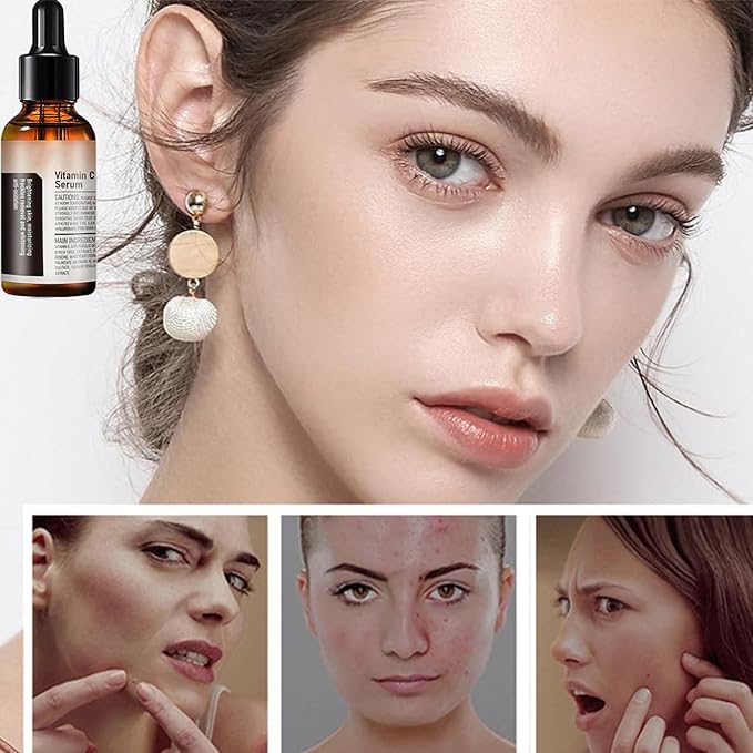 Vitamin C Serum For Face, Anti Aging Face Serum with Vitamin C, Hyaluronic Acid, Vitamin E – Brightening Formula – Improve Appearance of Dark Spots, Tone, Fine Lines & Wrinkles (2Pcs)