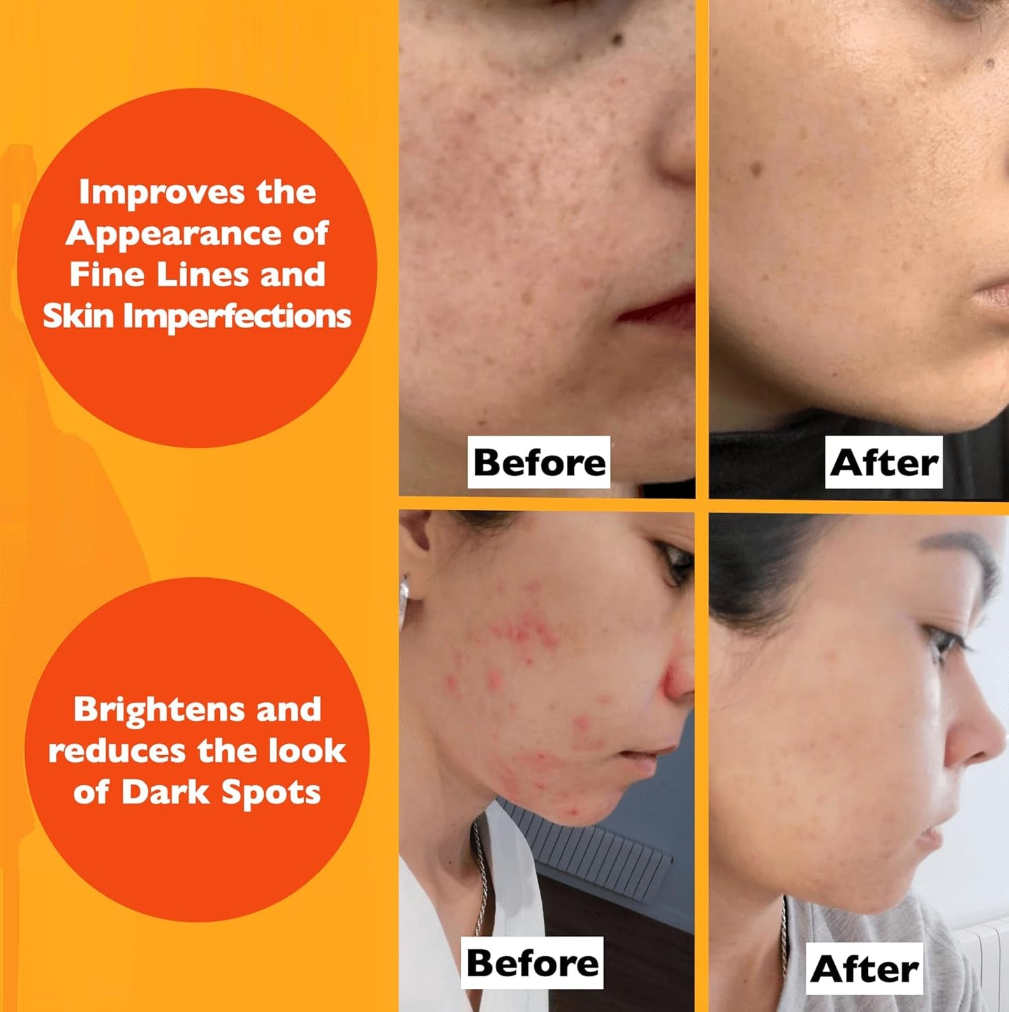 Vitamin C Serum For Face β Anti-Aging Facial Serum with Vitamin C, Hyaluronic Acid, Niacinamide, B5 & Vit E. Brightening Facial Essence for Dark Spots, Fine Lines, Wrinkles & Glowing Skin, 2 Fl Oz