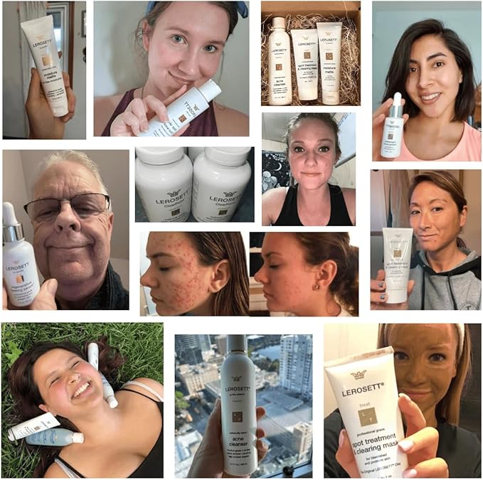 LEROSETT Toner for Clear Skin, Aloe Vera Based Toner with Glycolic Acid & 10 Calming Botanicals Helps Reduce Irritation, Future Blemishes, Blackheads, and Tightens Pores, Natural, Vegan - 6.7 oz