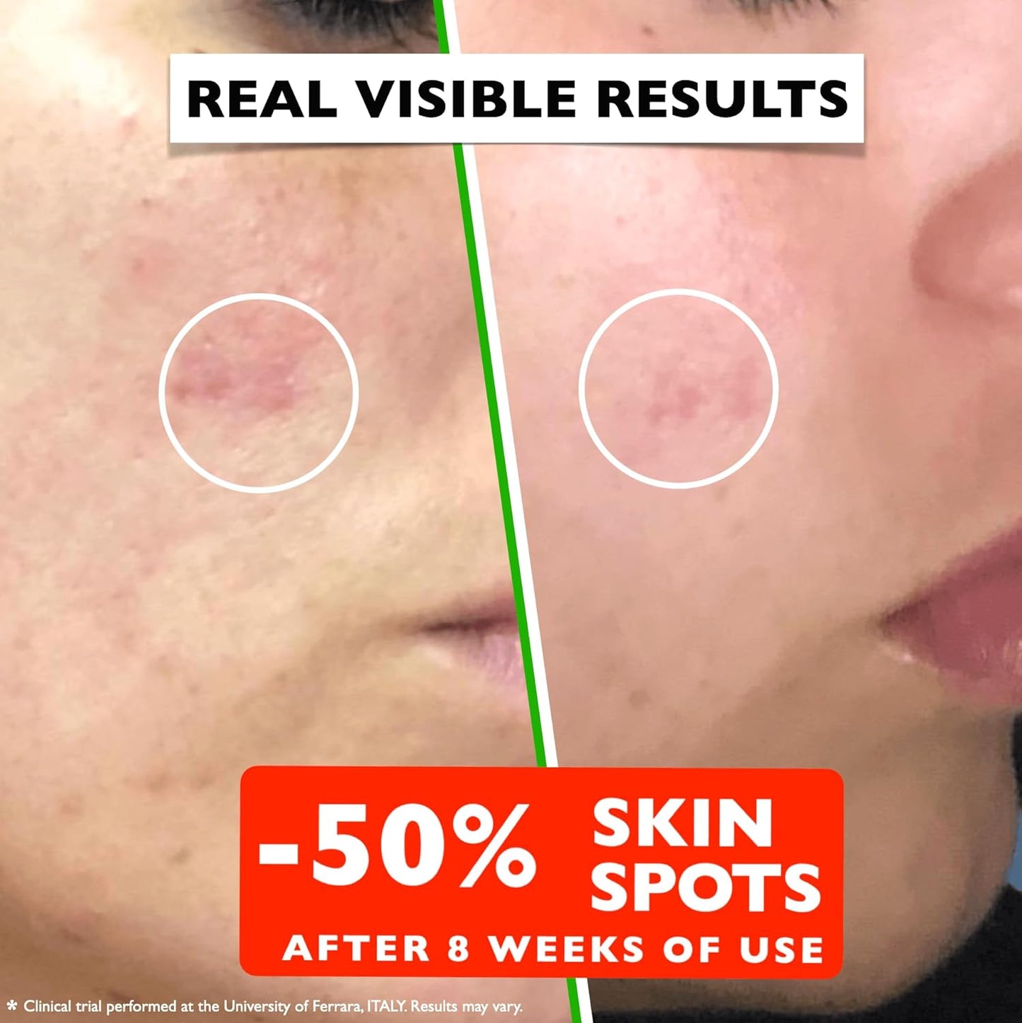 Vitamin C Serum For Face β Anti-Aging Facial Serum with Vitamin C, Hyaluronic Acid, Niacinamide, B5 & Vit E. Brightening Facial Essence for Dark Spots, Fine Lines, Wrinkles & Glowing Skin, 2 Fl Oz