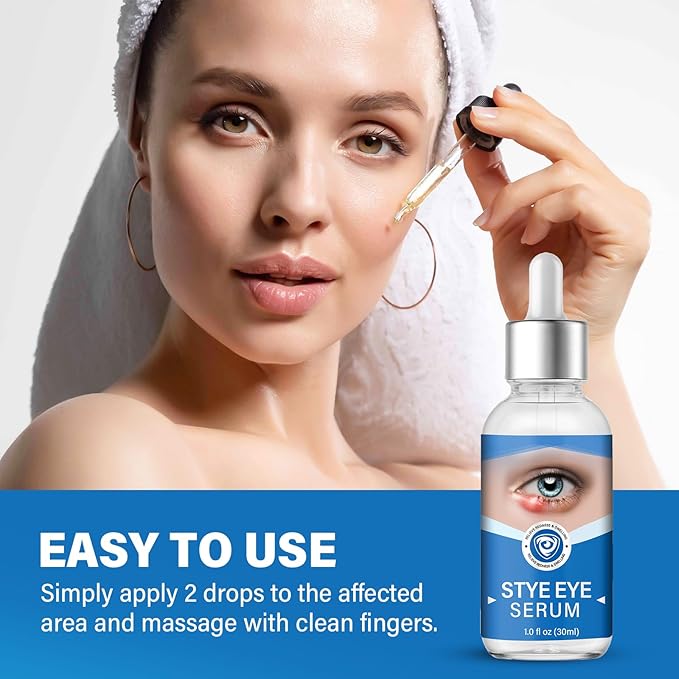 Stye Eye Treatment, Stye Eye Serum for Styes Chalazion and Blepharitis, Gently Cleanses Lashes and Eyes, Restore Healthier Eye Skin, 1 Fl.oz