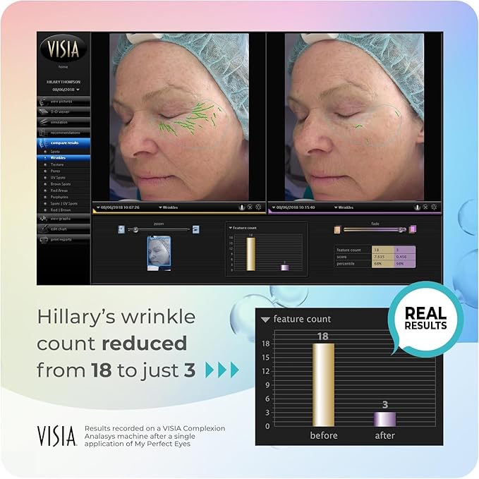 My Perfect Eyes 20ml, 200 Applications, Penny Lane, Instant Results, Clinically Proven, Anti-Ageing Serum UK Original Formula, Science-Backed Anti-Wrinkle Serum. As Seen on TV.