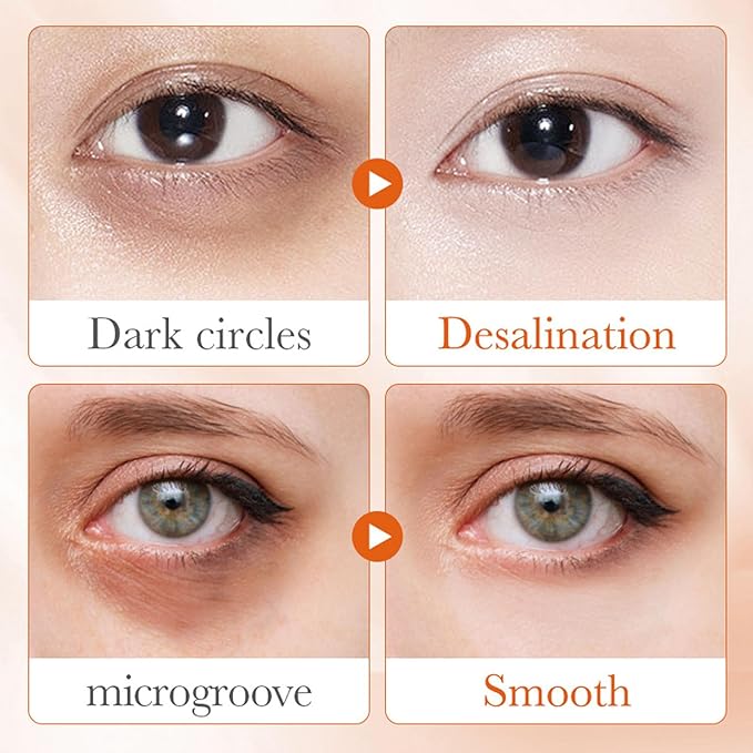 Eye Cream For Dark Circles, Vitamin C Eye Cream For Dark Circles, Puffiness and Bag, Anti Aging Eye Cream Firming Skin, Reduces Fine Lines, Moisturizing Eye Cream for Dry Skin around Eyes