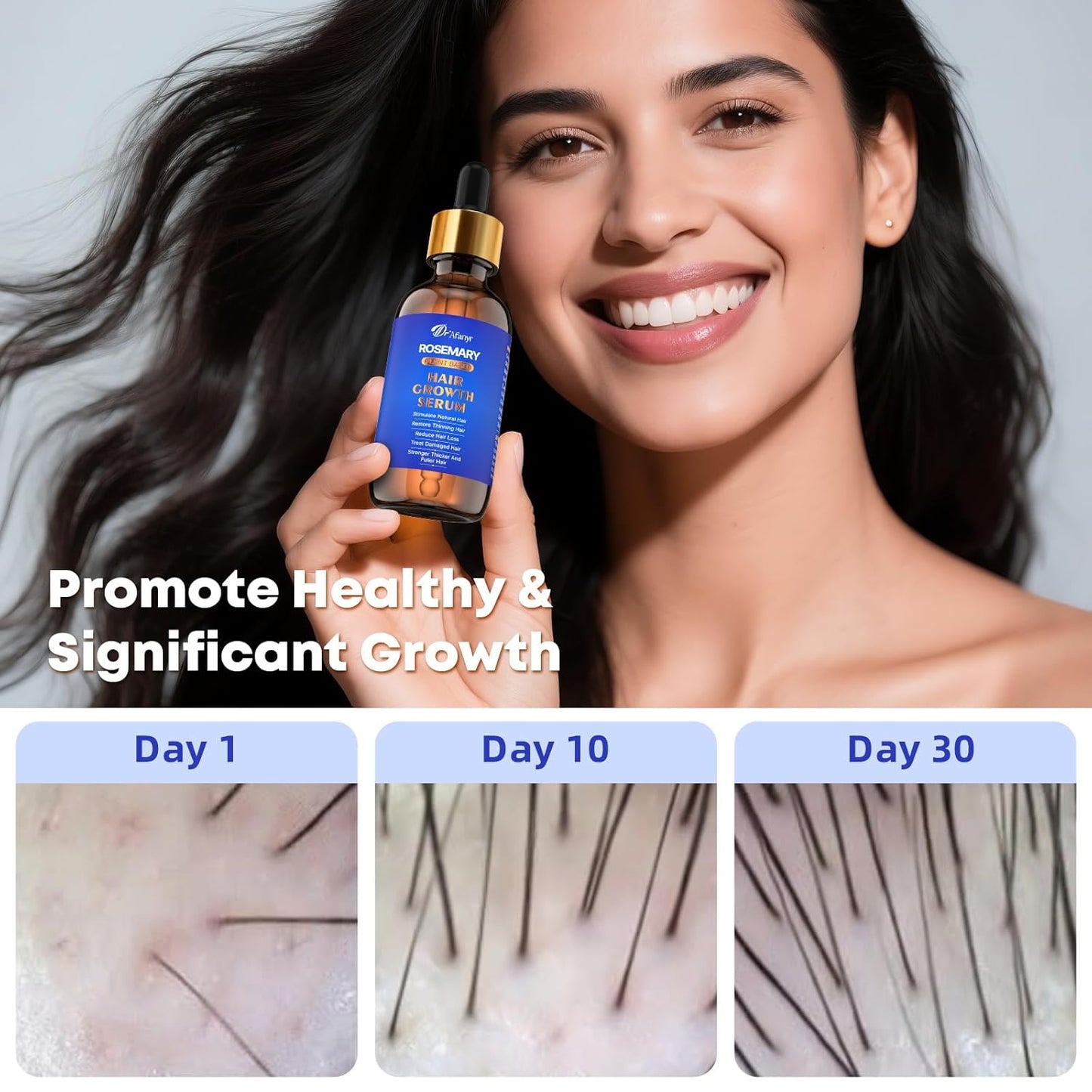 Hair Growth Serum with Rosemary Oil & Saw Palmetto - 100% Natural Plant-Based Formula to Stimulate Follicles, Revive Roots for Visibly Thicker Fuller Hair, Reduce Shedding and Loss For Men & Women