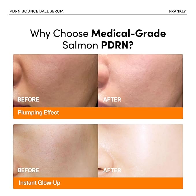 FRANKLY Salmon PDRN Bounce Ball Serum – PDRN Salmon DNA Serum for Plumping, Firming & Glass Skin | Glowing skin Booster | Lightweight, Non-Sticky Korean Skincare | 1.01 fl oz