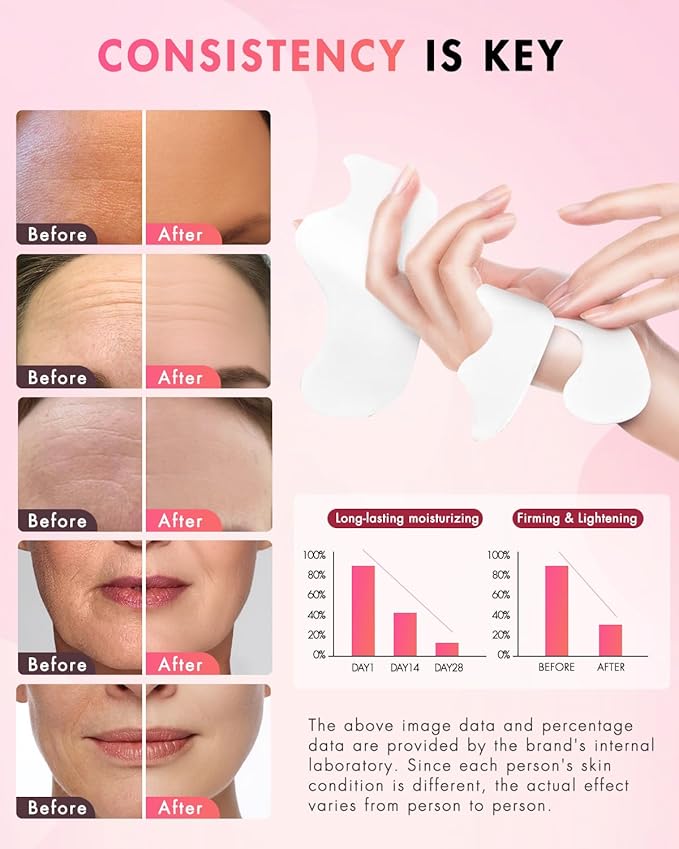 Forehead Wrinkle Patches & Smile Line Patches, Overnight Facial Wrinkle Treatment with Hyaluronic Acid, Aloe, Collagen & Vitamin E to Lift Smile Lines for Women 72pcs
