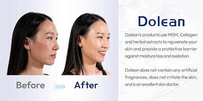 Relaxing Mist Facial Spray With Msm And Collagen, Face Mist Hydrating And Redness Remedy,No Artificial Fragrance, Body/Skin Care, 4 Fl Oz