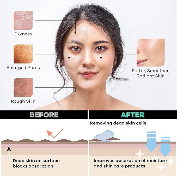 Dermasuri Deep Exfoliating Face Mitt - Scrubber, Dead and Dry Skin Remover for Men and Women - Exfoliator Gloves for Shower and Dry Use - ( 1 Pack)