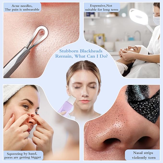 Skin Scrubber Face Spatula Skin Spatula Pore Cleaner Blackhead Remover Tools for Facial Deep Cleansing Skin Care Tool for Men and Women (Purple)