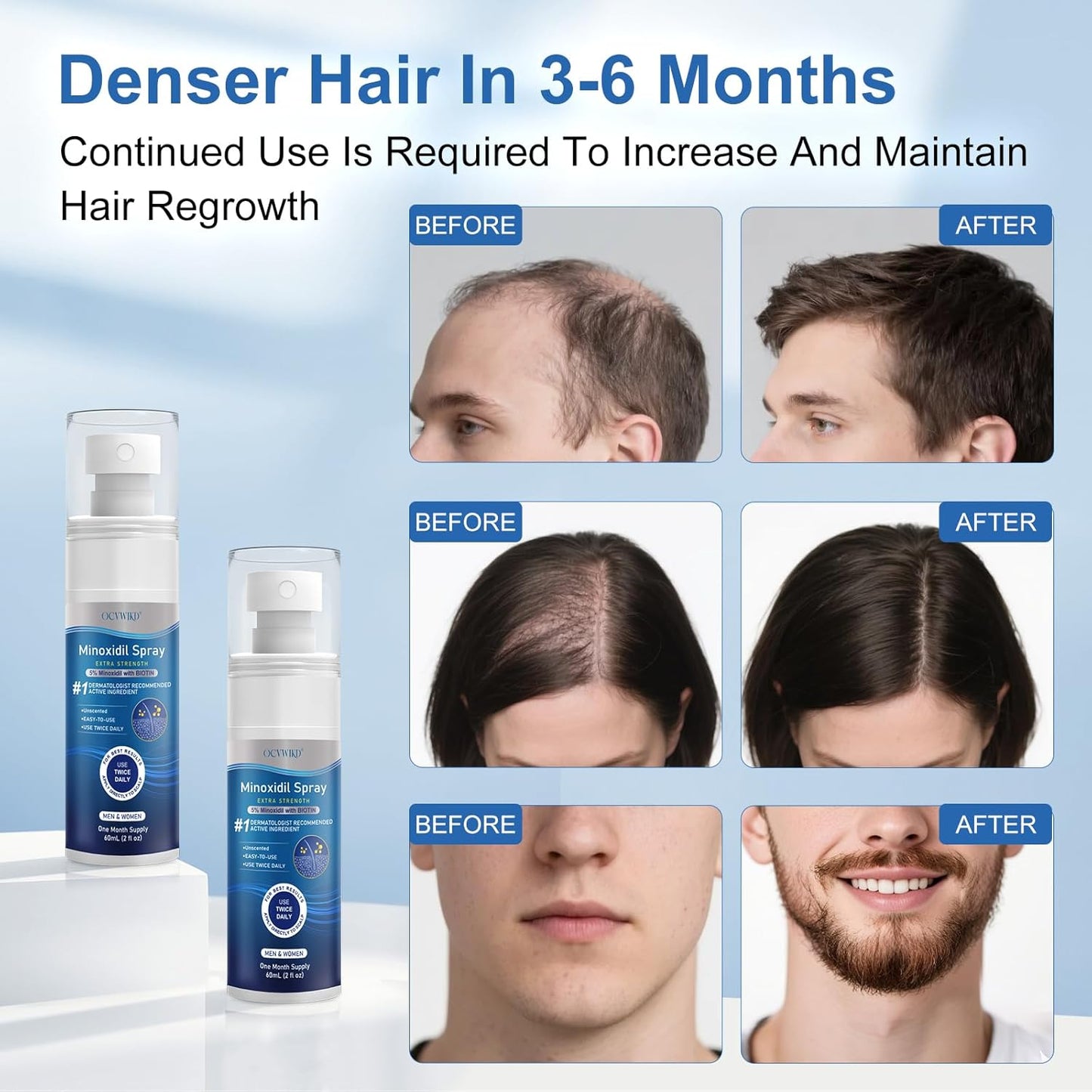 5% Minoxidil for Men and Women, Regrowth Serum, Extra Strength Spray for Hair Loss, Minoxidil 5 Percent, Thicker Healthier Hair, Beard Growth Kit, Topical Treatment, 60ml x 7 Bottles(Extra Strength)