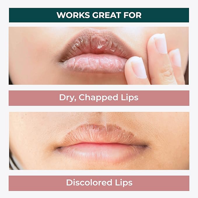 Minimo Candy Lip Exfoliator Scrub & Moisturizer - Lip Scrubber Exfoliator- Lip Brightening For Dark Lips Smoker| Removes Dead Skin from Dry Chapped Lips - Nourishes & Hydrates(1 oz) Juicy Watermelon
