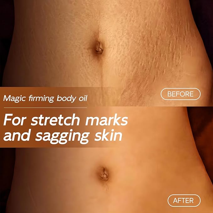 Magic Body Firming Oil, 3.38 FL OZ, Korean Skin Care Post-Shower Body Oil for Women – With 767,000ppm Jojoba Oil,to Tighten, Hydrate & Nourish Dry Skin, Lightweight & Non-Greasy for Full Body Use