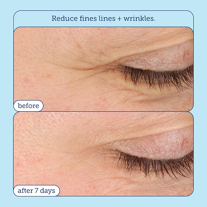 Skinfix Barrier+ Triple Lipid-Boost 360° Eye Cream: Targets Dark Circles, Puffiness, and Fine Lines Around Eyes and Lids, Clinically Proven to Brighten and Refresh Eyes, 0.5 oz