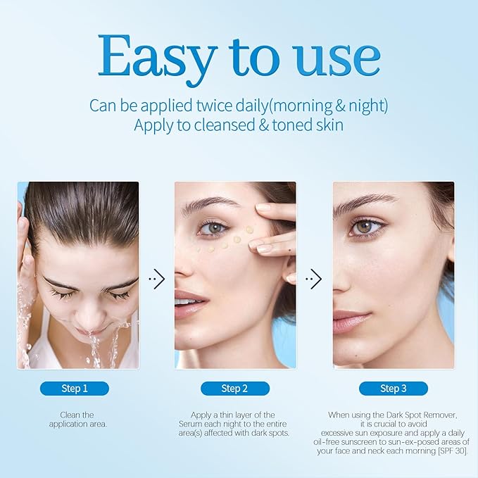 Dark Spot Remover for Face,Dark Spot Corrector, Dark Spot Serum for Sun Spots, Age Spots, Brown Spots,Acne Scars,Melasma Brown Spot -Advanced Formula with Niacinamide Retinol for Women (1.0 Fl Oz)