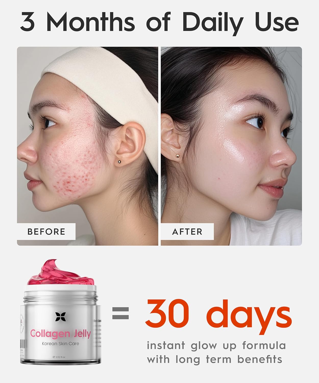 REVO Collagen Jelly β Korean Anti-Aging Plumping Formula with Hydrolyzed Collagen, Niacinamide, Hyaluronic Acid & Vitamin C β Skincare for Glass Glow Skin, Wrinkle Repair & Even Tone (3.52 Fl Oz)