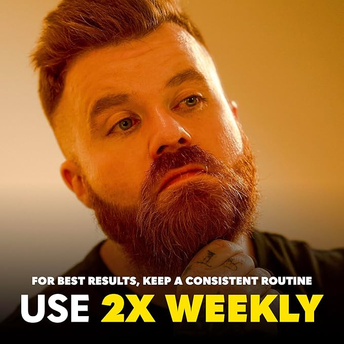 The Beard Club Derma Roller for Face, Body and Scalp - Microneedling Roller for Men and Women with 540 Titanium Microneedles - Beard Roller & Micro Needling Scalp Hair - Black