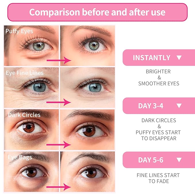 BREYLEE Pink Rose Eye Mask– 60 Pcs - Puffy Eyes and Dark Circles Treatments – Look Younger and Reduce Wrinkles and Fine Lines Undereye, Improve and Firm eye Skin - Pure Natural Material Extraction