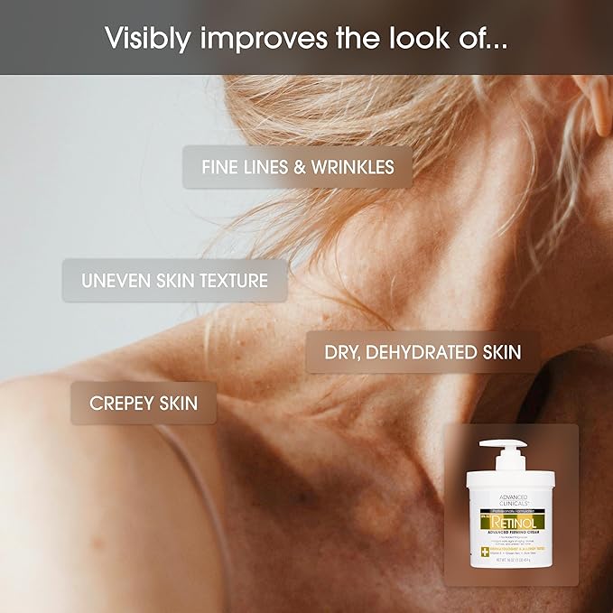 Advanced Clinicals Retinol Body Lotion Moisturizer Face Lotion & Body Cream | Crepey Skin Care Treatment Targets Look Of Crepe Skin, Wrinkles, Sagging Skin, & Sun Damaged Skin, 16 Oz