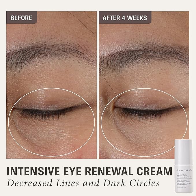 SHANI DARDEN SKINCARE Intensive Eye Renewal Cream, Anti-Aging Eye Cream for Fine Lines, Crow’s Feet and Dark Circles, Crease-Free and Makeup-Ready, 0.50 fl oz