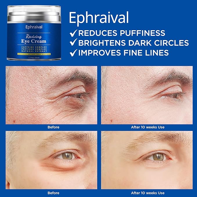 Men's Eye Cream, Eye Cream for Dark Circles and Puffiness, Anti-aging Caffeine Eye Cream for Men, Brightens, Reduces Puffiness, Dark Circles, and Fine Lines, Eye Treatment for Men Women