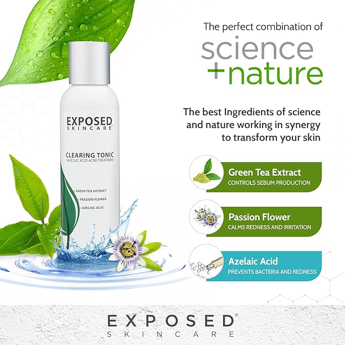 Exposed Skin Care Clearing Tonic Facial Toner with 1% Salicylic Acid and Witch Hazel for Acne Treatment – Pore Minimizing Toner to Prevent Breakouts, Reduce Redness and Balance Skin – Step 2 (4 fl oz)