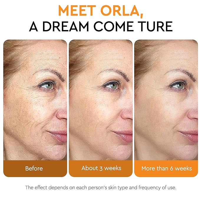 Super Vitamin C Serum For Women Over 70,Vitamin C Face Serum For Women Anti Aging Dark Spot Remover For Face Skin Care, Targets Age Spots, Wrinkles, Brightening, Pore Minimizer, Hydration 1.7fl Oz