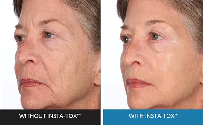 Serious Skincare INSTA-TOX Facial Firming Wrinkle Smoothing Serum and Reverse Lift Firming Eye Cream Set - Filler for Fine Lines, Deep Wrinkles and Pores - Temporary Eye Tightener