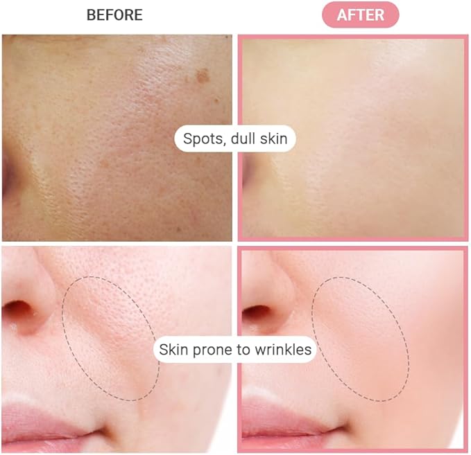 TENZERO Pink Hyaluronic Acid Niacinamide Serum Heart Pad (50 Count, 150g), Hydrating & Brightening Glowing Face Toner Pads, Korean Facial Radiance Pads, Dry Skin