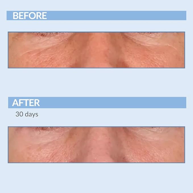 Retinol Vitamin A Resurfacing Pads for Daily Facial Treatment - Niacinamide & Witch Hazel - Exfoliates Skin & Pores - Reduces Fine Lines and Wrinkles - Serious Skincare - 60 Pre-Moistened Disc