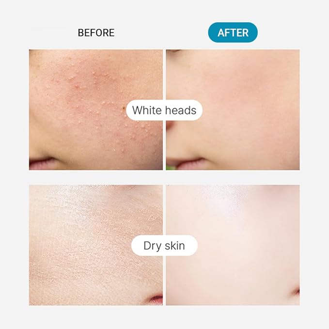 TENZERO Moisture Collagen Toner Pad (70 Count, 160g), 100% Natural Cotton, Hydrating Moisturizing Glowing Face Toner Pads, Gentle Exfoliate & Improve Elasticity, Korean Facial Toner, Dry & Dull Skin