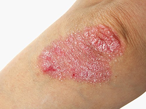 | Nutroleum Non Petroleum Skin Balm | All Natural Chemical Free & Water Resistant Alternative to Petroleum Jelly | All Natural Personal Care (3 oz)