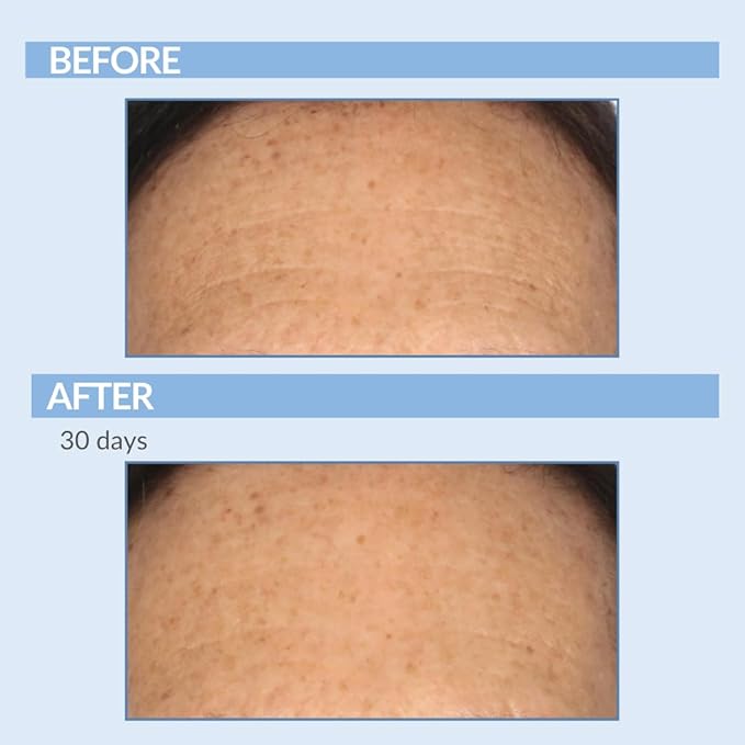 Vitamin A Force XR Retinol Serum Concentrate - Micro Exfoliate & Resurface for Radiant Skin - For Lines, Wrinkles - Pore Minimizer - Encapsulated Retinol for Anti-Aging - Serious Skincare - 1 Oz.