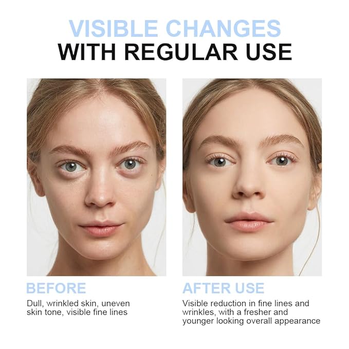 VGO Moisturizer Face Cream, 7-Fold Multi-Effect Repair Facial Cream, Daily Repair Moisturizer for Body and Face - Perfect for Every Skin Type 100ml / 3.53oz