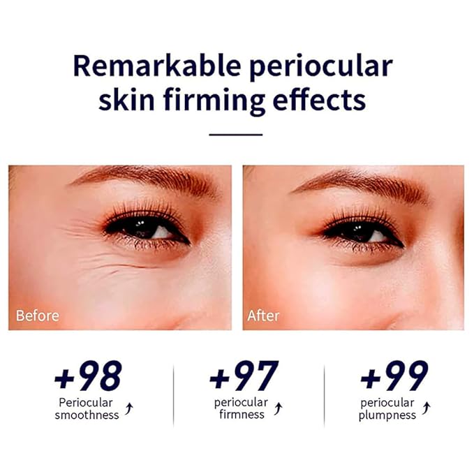 Snail Peptide Eye Cream Non-Sticky Snail Mucin Eye Care Hydrating Essence with 360° Massage Ball for Reducing Dark Circles/Puffiness/Fine Lines, Moisturizing, Firming, Adding Skin Elasticity
