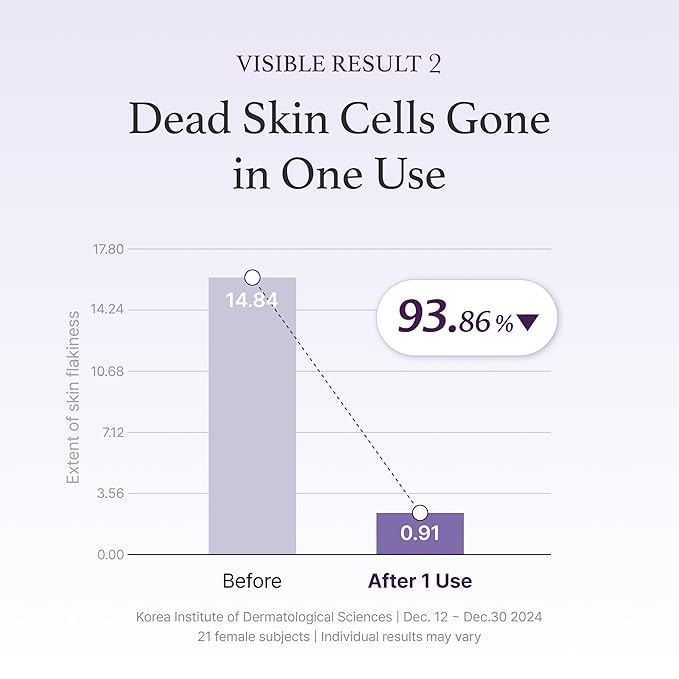 I'm from Black Rice Toner for Oily Skin, Sebum Control Toner, Lightweight, Niacinamide, Panthenol, Fragrance Free, Korean Skin Care, 150ml, 5.07 fl.oz