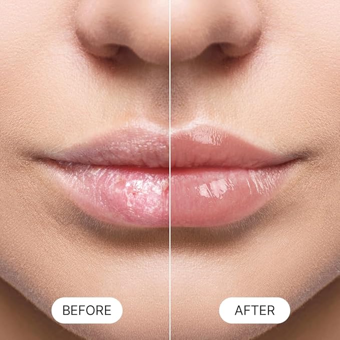 Essential Lip Balm Blue Collagen (GREEN CICA)