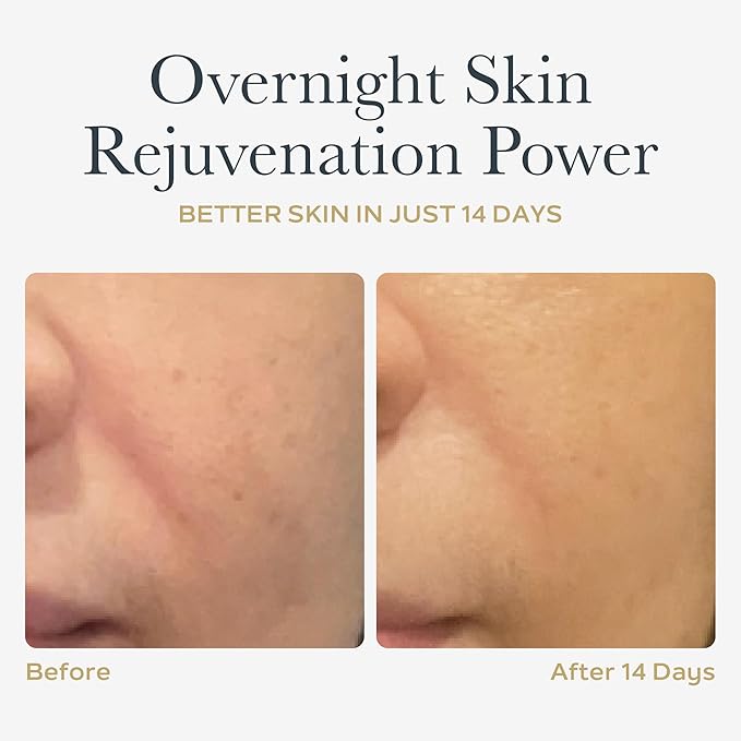 SOTHYS Renovative Micro-Capsules - Vitamin C Serum for Face | Vegan Capsules | Anti-Aging, Dark Spot | Night Treatment | 60 x .01 Fl Oz