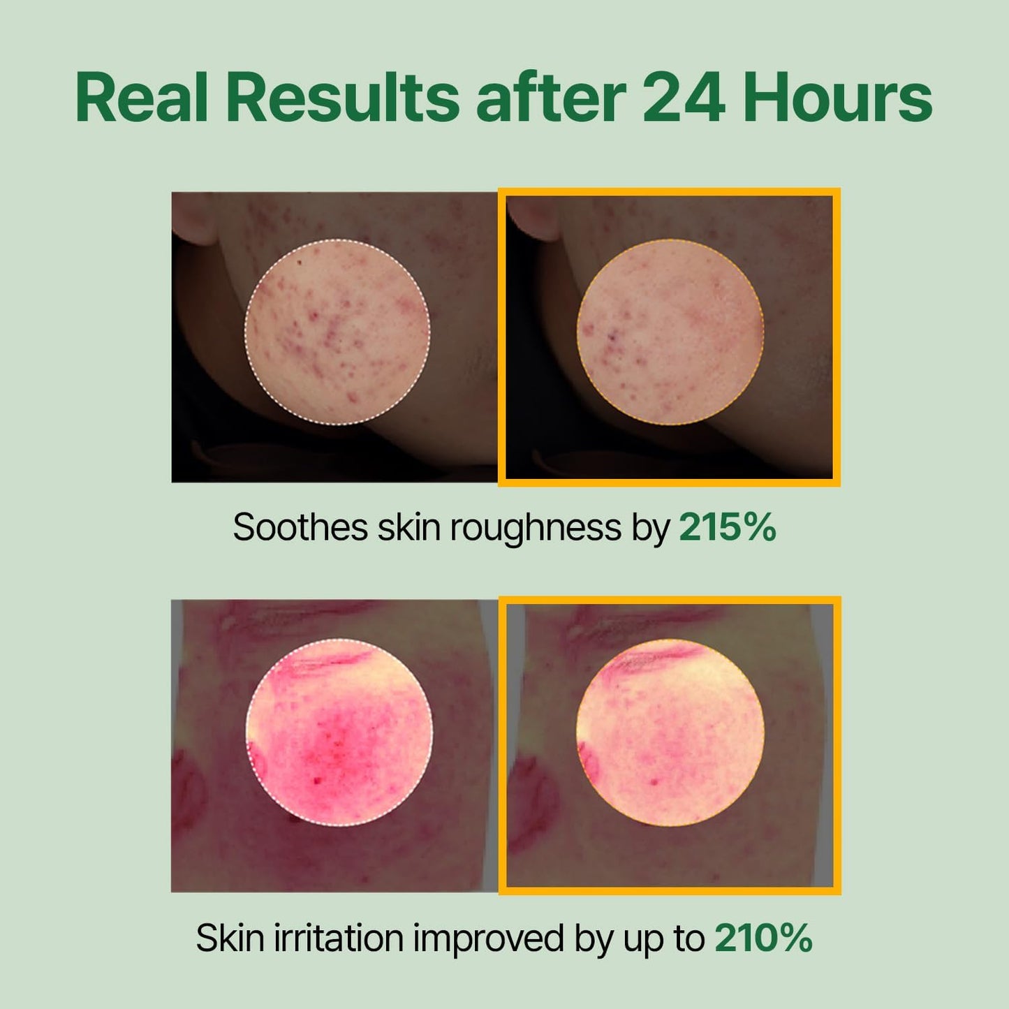 Mugwort Super Calming Toner - Korean Hydrating Toner for face, Purifying Mugwort Essence, Soothing, Calming, Refreshing Facial Toner for Oily, Dry, and Sensitive Skin, Daily Skin Care, 8.45 fl.oz