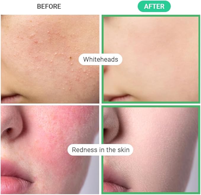 TENZERO Heart Leaf CICA Essence Heart Pad (50 Count, 150g), Redness Relief Soothing Pore Care for Sensitive Skin, Korean Facial Toner Pads, Hydrating & Refreshing, Centella