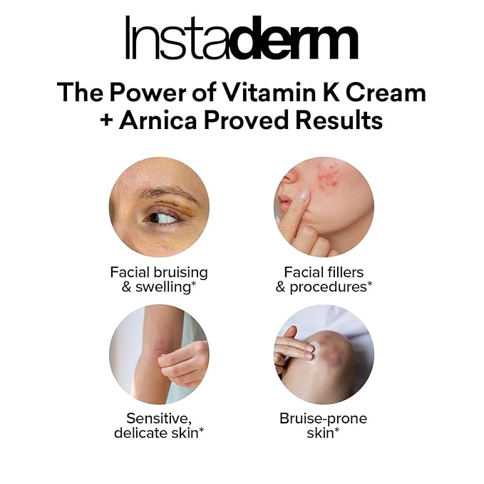 Vitamin K Cream- Bruise Healing Formula with Arnica. Dark Spot Moisturizer for Bruising, Spider Veins & Broken Capillaries. Repair Under Eye Dark Circles, & Puffiness.